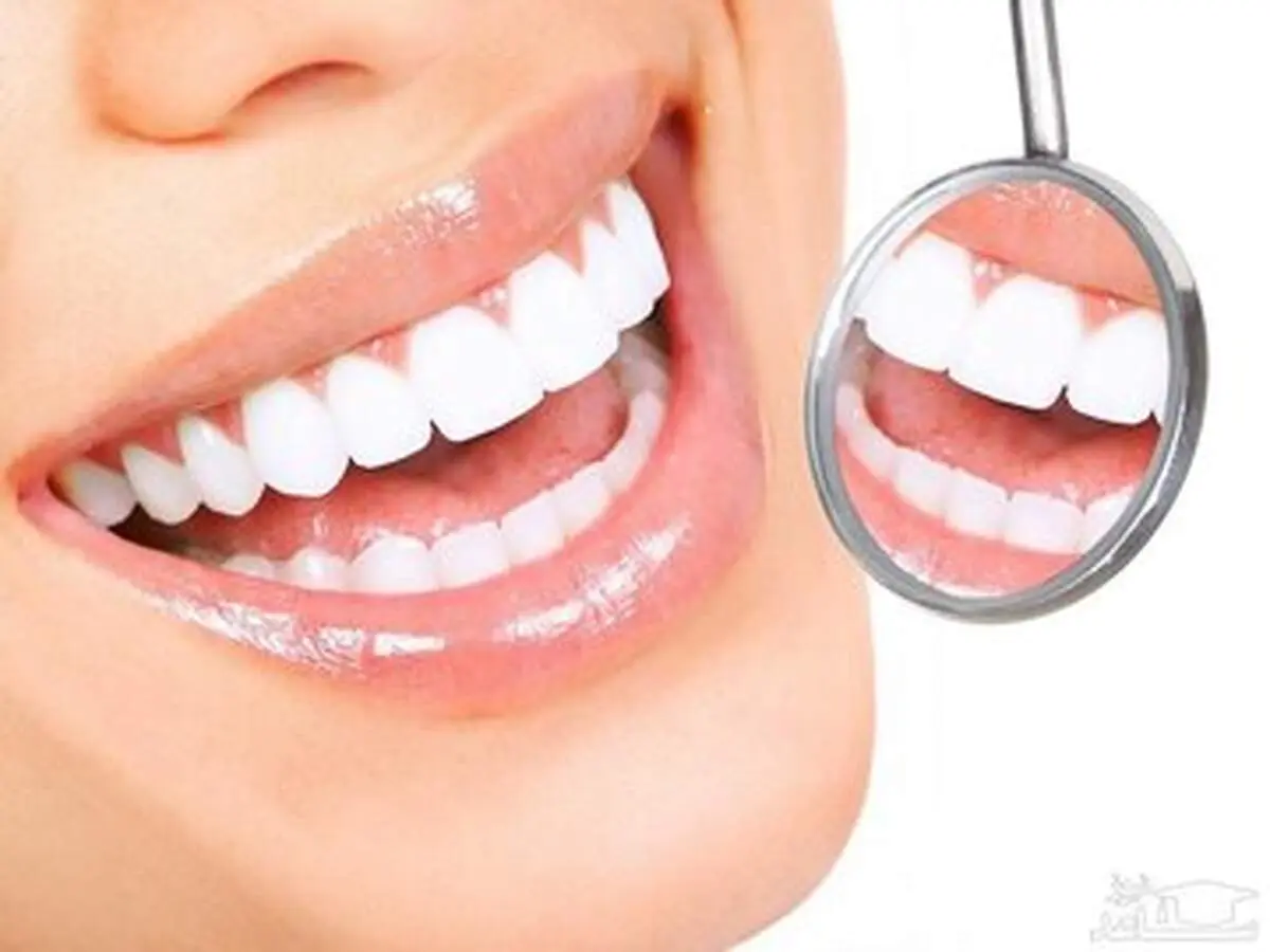چه کنیم عفونت لثه نگیریم؟ 