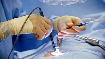 انجام عمل جراحی پیچیده و صعب العلاج توسط دکتر حسین قناعتی رئیس دانشگاه علوم پزشکی تهران در بیمارستان گاندی+ فیلم