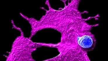 امید تازه در نبرد با سرطان پانکراس؛ درمان ایمنی سلولی محققان یو‌سی‌ال‌ای موفق شد تومورها را نابود کند