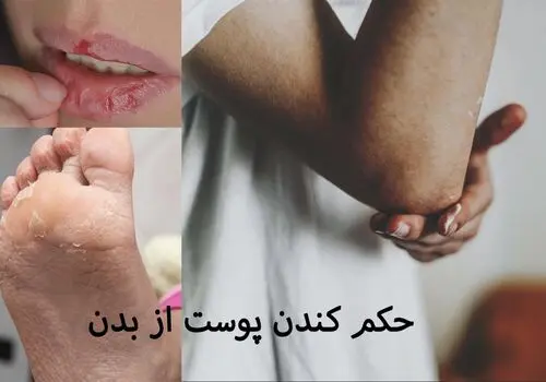 سریع ترین روش پاک کردن لکه های سیاه گردو
