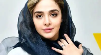 المیرا دهقانی استایل فرهاد آئیش را کپی کرد!