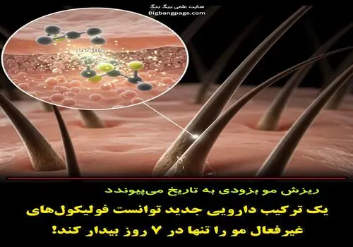 ۷ ویتامین کلیدی برای مقابله با ریزش مو و تقویت رشد