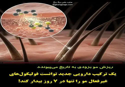 داروی جدید ضد ریزش مو وارد مرحله دوم آزمایش انسانی شد؛ نتایج امیدوارکننده در یک هفته