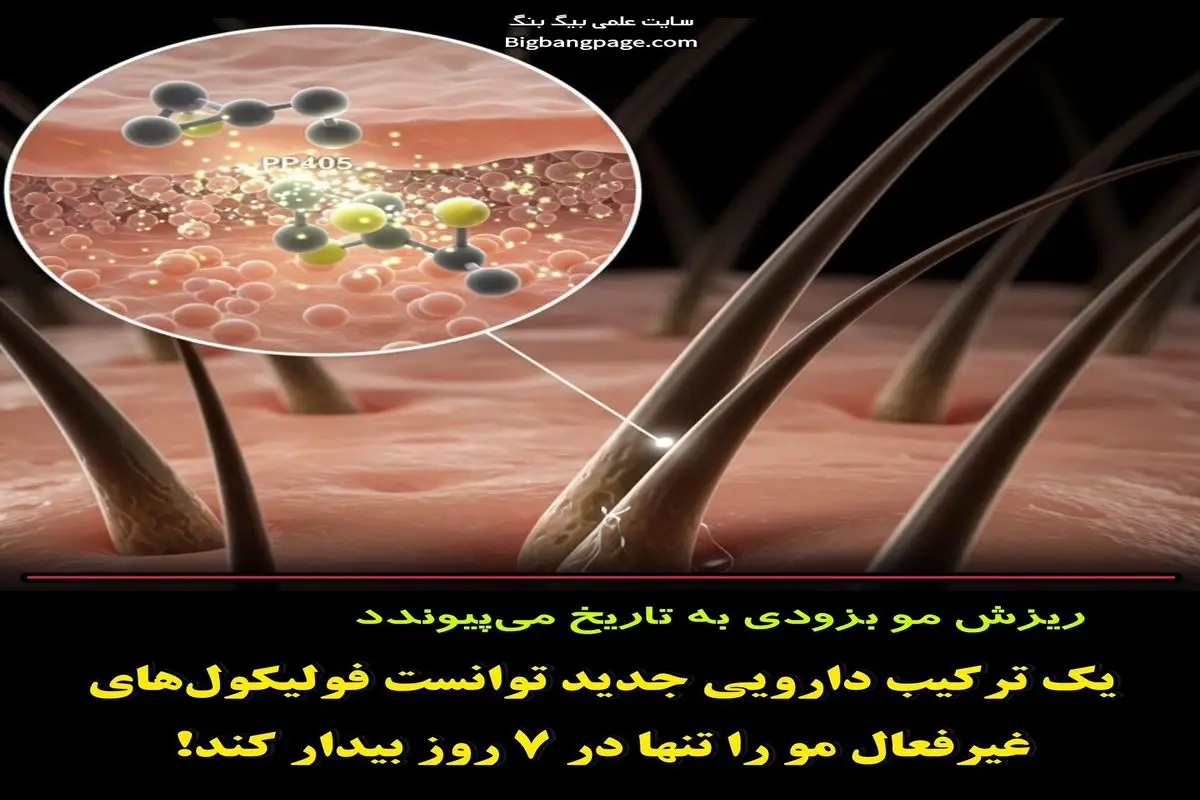 داروی جدید ضد ریزش مو وارد مرحله دوم آزمایش انسانی شد؛ نتایج امیدوارکننده در یک هفته