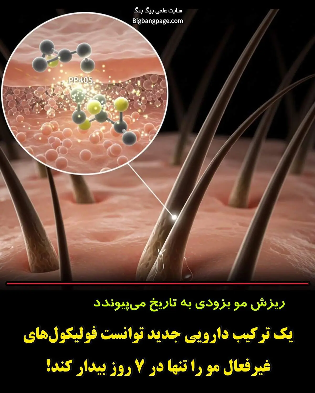داروی جدید ضد ریزش مو وارد مرحله دوم آزمایش انسانی شد؛ نتایج امیدوارکننده در یک هفته