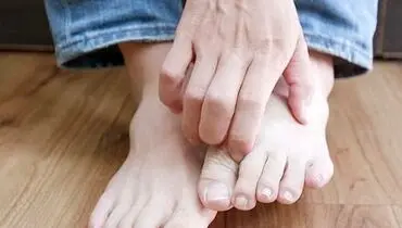 بیماری‌های خطرناکی که علائم آن در پا ظاهر می شوند