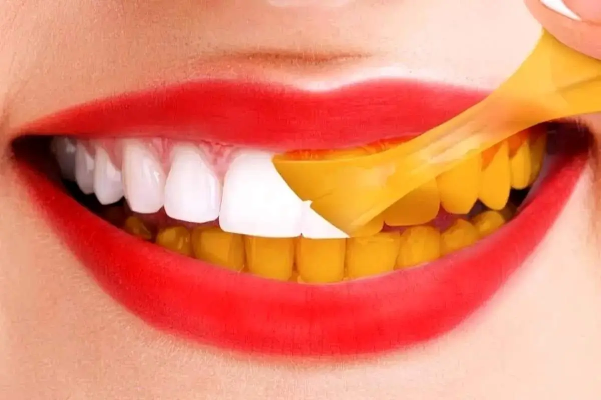 بعد از خوردن این خوراکی ها مسواک نزنید|