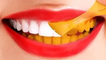 بعد از خوردن این خوراکی ها مسواک نزنید|