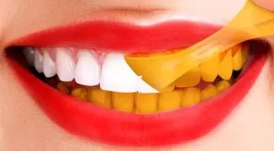 بعد از خوردن این خوراکی ها مسواک نزنید|