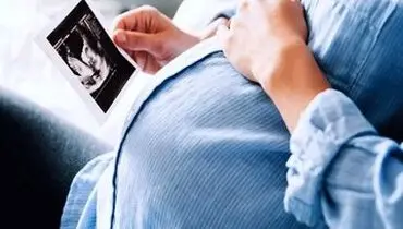 جزییات ویزیت آنلاین برای مادران باردار 