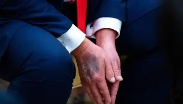 افشاگری نماینده مجلس درباره بیماری خطرناک آقای رئیس‌جمهور! +عکس

