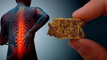 غذا‌های مفید برای جلوگیری از پوکی استخوان