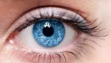 ۴ درصد ایرانی‌ها دچار این مشکل چشمی هستند
