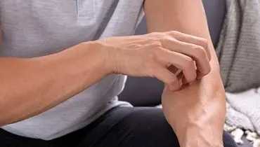 باشگاه ورزشی و خطر پنهان برای پوست؛ مراقب این ۶ بیماری باشید