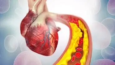 
کاهش کسترول خون با این ماده غذایی مقوی