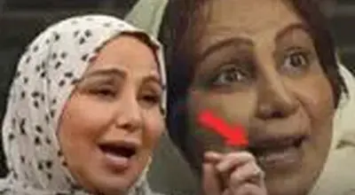 فداکاری بهنوش بختیاری برای نقش جدید/ جزئیات تراشیدن دندان‌ها/ویدیو 