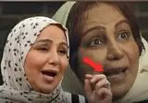 فداکاری بهنوش بختیاری برای نقش جدید/ جزئیات تراشیدن دندان‌ها/ویدیو 