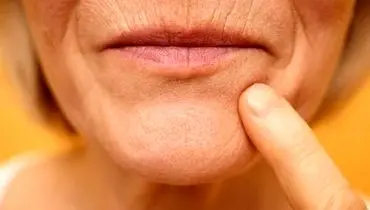 چرا با افزایش سن لب‌ها نازک‌تر به نظر می‌رسند؟