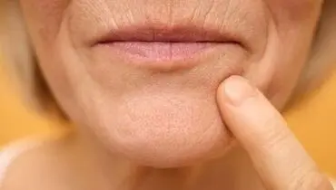 چرا با افزایش سن لب‌ها نازک‌تر به نظر می‌رسند؟