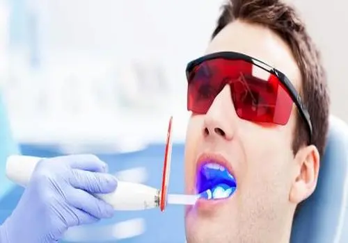 روشی نوین برای بازیابی مینای دندان بدون پرکردن