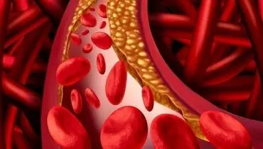 برای کاهش چربی خون چه کنیم؟