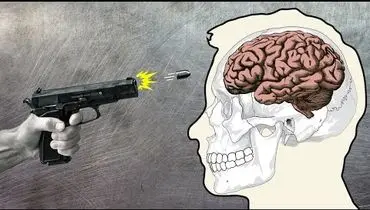 پس از ورود گلوله به مغز چه اتفاقی می‌افتد؟+ فیلم