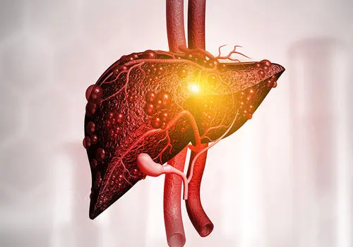 سبزیجات مؤثر در پیشگیری و درمان کبد چرب