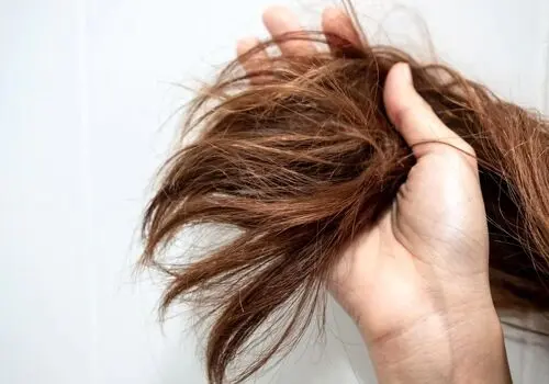 چگونه از موخوره جلوگیری کنیم؟
