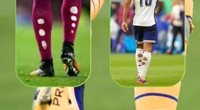 چرا ستاره های جام جهانی، جوراب های شان را پاره می کنند