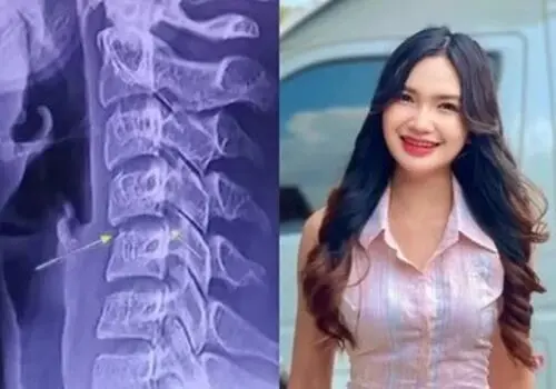 خطر پنهان ماساژهای غیراصولی؛ چرا نباید اجازه دهید روی پشت‌تان راه بروند؟