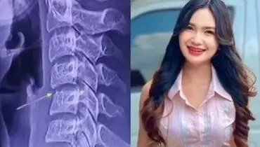 مرگ خانم خواننده بر اثر ماساژ! + عکس