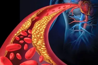 از سردرد تا تپش قلب؛ زنگ خطرهای فشار خون عصبی