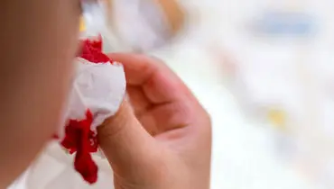 چگونه در جنگ خونریزی را کنترل کنیم؟