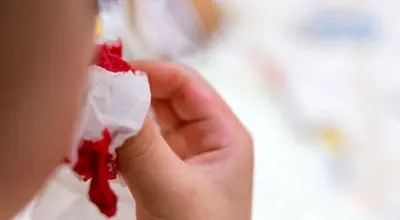 چگونه در جنگ خونریزی را کنترل کنیم؟