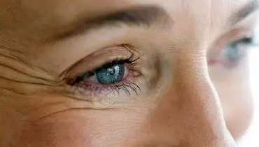 روش‌های طبیعی برای کاهش چین‌وچروک صورت