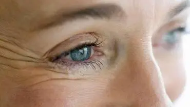 روش‌های طبیعی برای کاهش چین‌وچروک صورت