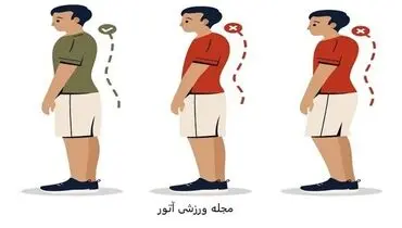 قوز کمر چیست؟