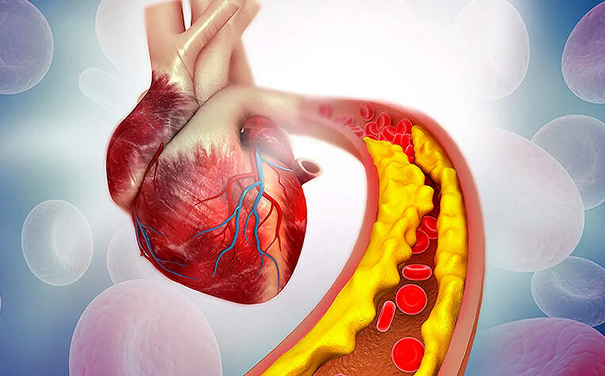 از کلسترول و تری گلیسرید بالا رنج می‌برید؟ این راهکارها برای شماست