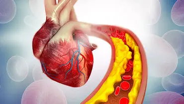 از کلسترول و تری گلیسرید بالا رنج می‌برید؟ این راهکارها برای شماست