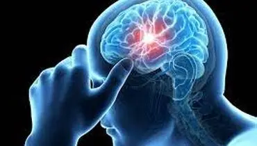در تومور مغزی کجای سردرد میگیرد ؟ هرآنچه باید بدانید
