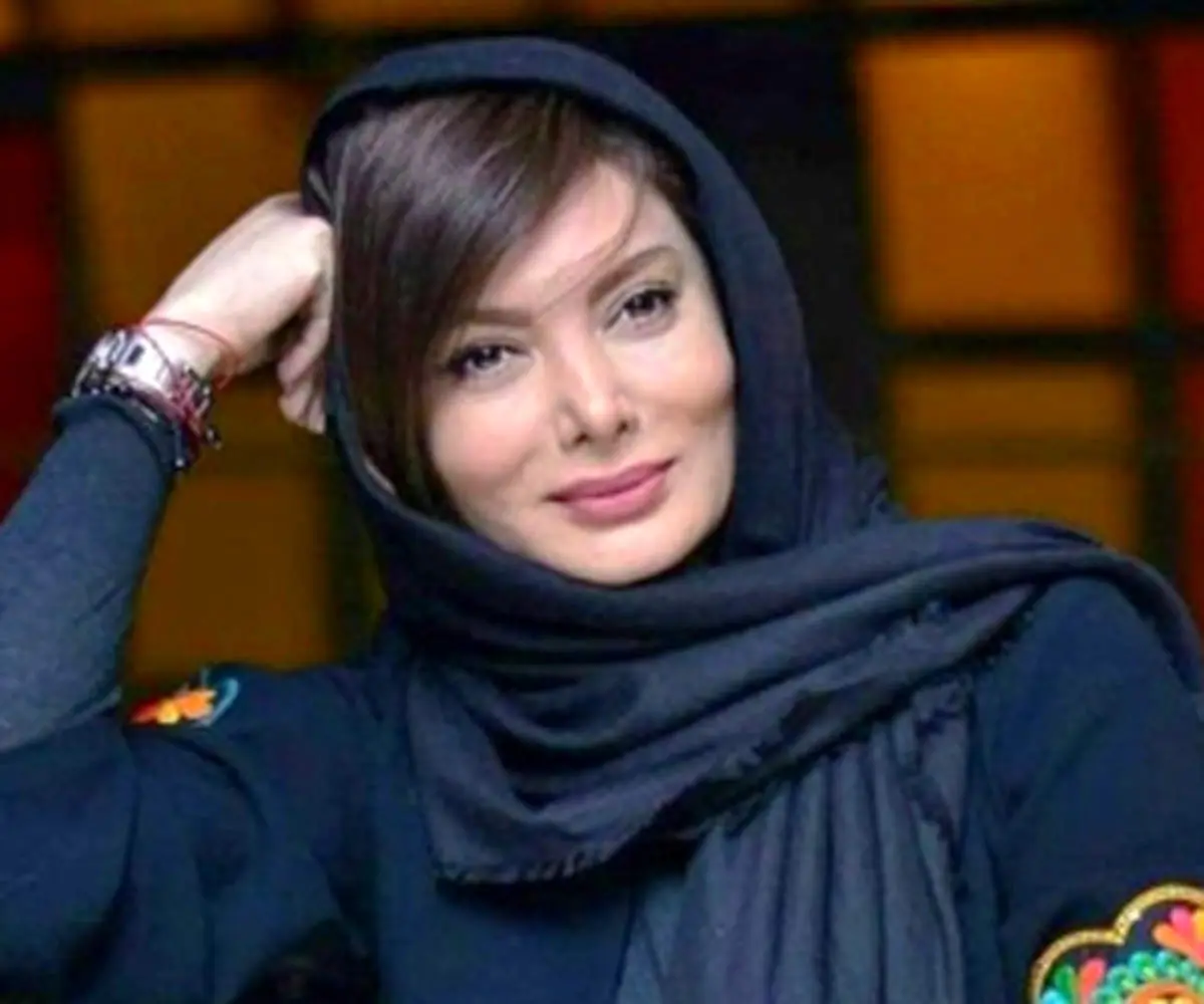 نگار فروزنده قبل از عمل زیبایی این شکلی بود+ عکس
