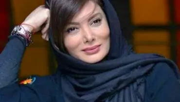 نگار فروزنده قبل از عمل زیبایی این شکلی بود+ عکس