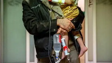 چالش جدی در درمان رایگان کودکان زیر ۷ سال