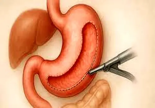 حرکت جدید، جنجالی و ترسناک در دنیای جراحی‌ زیبایی