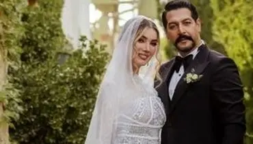 عکس پربازدیدِ متین ستوده قبل از عمل‌های زیبایی
