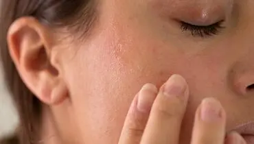 خوراکی‌هایی که موجب کم‌آب شدن پوست می‌شوند