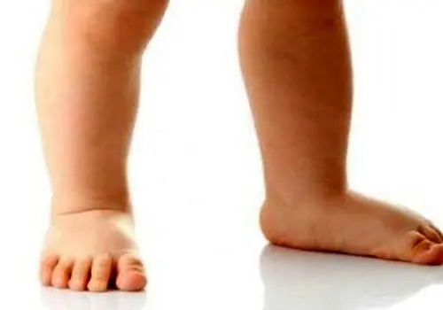 ۳ عامل اصلی چاقی و اضافه وزن را بشناسید
