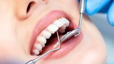 متهم ردیف اول رفلاکس معده را بشناسید
