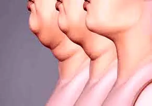 سیاه دانه برای چی خوبه