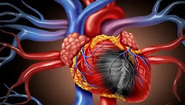 علائم اولیه بیماری چربی قلب را بشناسید